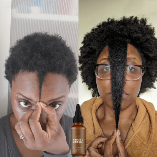 Unlock Longer, Thicker Hair in 2025: Why Chebe Hair Growth Oil Is the Natural Secret You Need
