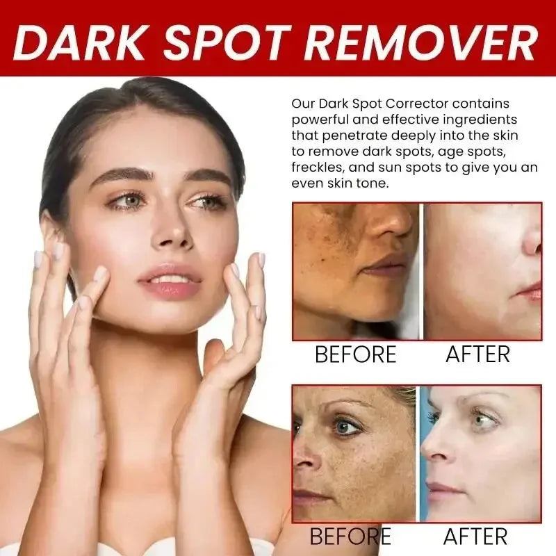 Derma Eterna™ Dark Spot Remover