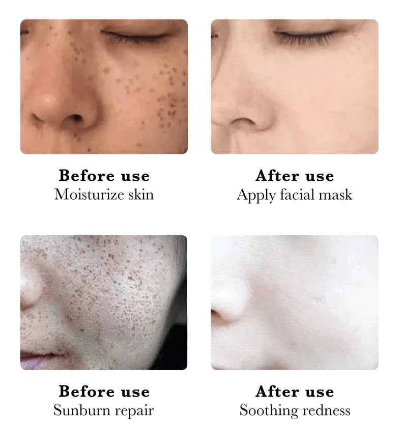 Derma Eterna™ Dark Spot Remover