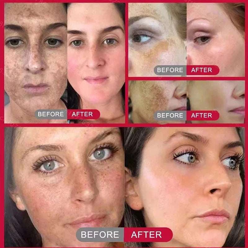 Derma Eterna™ Dark Spot Remover
